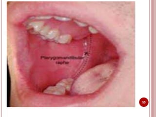 Anatomical landmarks of maxilla and mandible | PPTX
