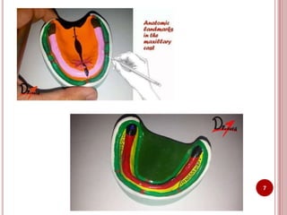 Anatomical landmarks of maxilla and mandible | PPTX