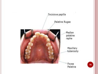 Anatomical landmarks of maxilla and mandible | PPTX