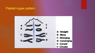 Radial Rugae Pattern Anatomical landmarks | PPTX