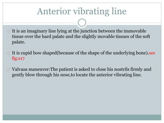 Anterior vibrating line
It is an imaginary line lying at the junction between the immovable
tissue over the hard palate and the slightly movable tissues of the soft
palate.
It is cupid bow shaped(because of the shape of the underlying bone).see
fig:s17
Valvasa maneuver:The patient is asked to close his nostrils firmly and
gently blow through his nose,to locate the anterior vibrating line.
 