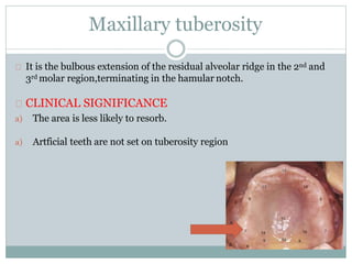 Maxillary tuberosity
It is the bulbous extension of the residual alveolar ridge in the 2nd and
3rd molar region,terminating in the hamular notch.
CLINICAL SIGNIFICANCE
a) The area is less likely to resorb.
a) Artficial teeth are not set on tuberosity region
 