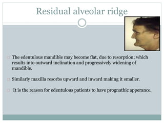 Residual alveolar ridge
The edentulous mandible may become flat, due to resorption; which
results into outward inclination and progressively widening of
mandible.
Similarly maxilla resorbs upward and inward making it smaller.
It is the reason for edentulous patients to have prognathic apperance.
 