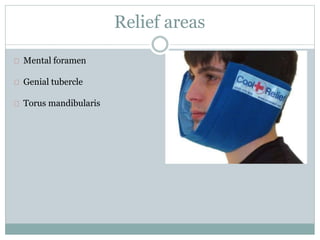 Relief areas
Mental foramen
Genial tubercle
Torus mandibularis
 