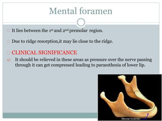 Mental foramen
It lies between the 1st and 2nd premolar region.
Due to ridge resorption,it may lie close to the ridge.
CLINICAL SIGNIFICANCE
a) It should be relieved in these areas as pressure over the nerve passing
through it can get compressed leading to paraesthesia of lower lip.
 