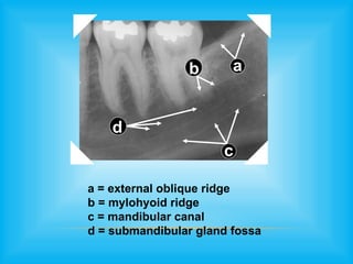 Oblique Ridge Radiography ANATOMICAL LANDMARKS anatomy and physiology.pptx