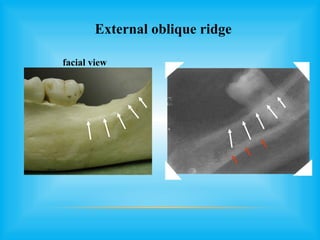 Obliuqe Ridge ANATOMICAL LANDMARKS anatomy and physiology.pptx