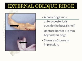 Posterior Ridge ANATOMICAL LANDMARKS OF ANATOMICAL STRUCTURES.ppt