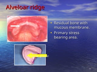 Define Alveolar Ridge ANATOMICAL LANDMARKS of maxillary and mandibulat arches.ppt