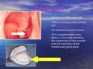 ANATOMICAL LANDMARKS of maxillary and mandibulat arches.ppt
