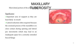 MAXILLARY
TUBEROSITY
Most distal portion of the alveolar ridge
Significance
Important area of support as they are
least likely to resorb
Lateral reduction often required because
the coronoid process of the mandible is in
close contact during opening and lateral
jaw movements which may lead to an
inadequate space for a correctly extended
buccal flange
18
 