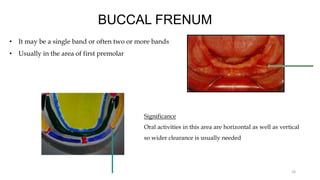 BUCCAL FRENUM
• It may be a single band or often two or more bands
• Usually in the area of first premolar
26
Significance
Oral activities in this area are horizontal as well as vertical
so wider clearance is usually needed
 