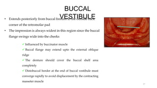 BUCCAL
VESTIBULE
• Extends posteriorly from buccal frenum to the outside back
corner of the retromolar pad
• The impression is always widest in this region since the buccal
flange swings wide into the cheeks
27
 Influenced by buccinator muscle
 Buccal flange may extend upto the external oblique
ridge
 The denture should cover the buccal shelf area
completely
 Distobuccal border at the end of buccal vestibule must
converge rapidly to avoid displacement by the contracting
masseter muscle
 