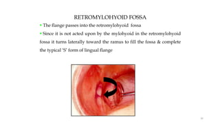 RETROMYLOHYOID FOSSA
 The flange passes into the retromylohyoid fossa
 Since it is not acted upon by the mylohyoid in the retromylohyoid
fossa it turns laterally toward the ramus to fill the fossa & complete
the typical ‘S’ form of lingual flange
32
 