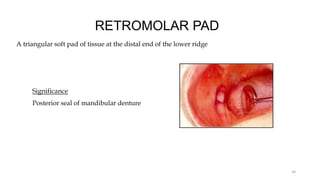 RETROMOLAR PAD
A triangular soft pad of tissue at the distal end of the lower ridge
Significance
Posterior seal of mandibular denture
34
 