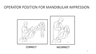 OPERATOR POSITION FOR MANDIBULAR IMPRESSION
CORRECT INCORRECT
46
 