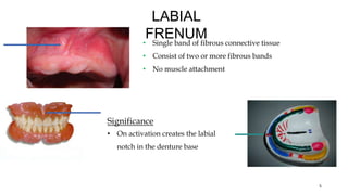 LABIAL
FRENUM
• Single band of fibrous connective tissue
• Consist of two or more fibrous bands
• No muscle attachment
5
Significance
• On activation creates the labial
notch in the denture base
 