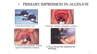 • PRIMARY IMPRESSION IN ALGINATE
4. Tray should be adjusted by
bending .
1.Selection of stock tray. 2. Position borders at hamular notches.
3. Lift the tray anteriorly, 3-5 mm
space for impression material.
52
 