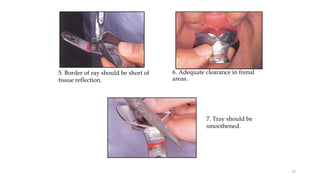 5. Border of ray should be short of
tissue reflection.
6. Adequate clearance in frenal
areas.
7. Tray should be
smoothened.
53
 