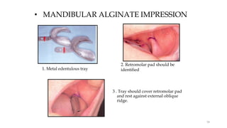 • MANDIBULAR ALGINATE IMPRESSION
3 . Tray should cover retromolar pad
and rest against external oblique
ridge.
1. Metal edentulous tray
2. Retromolar pad should be
identified
58
 