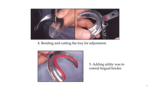 4. Bending and cutting the tray for adjustment.
5. Adding utility was to
extend lingual border.
59
 