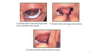 7. Patient told to do tongue movements.
6. Patient told to raise the tongue and
tray is rotated in the mouth.
8. Gently mold the labial and buccal areas.
60
 