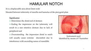 It is a displaceable area about 2mm wide
Situated between tuberosity of maxilla and hamulus of the pterygoid plate
HAMULAR NOTCH
Instrument used
Identified by means of T burnisher
9
Significance
 Determines the distal end of denture
 Ending the impression on the tuberosity will
result in a non retentive denture due to lack of
peripheral seal
 Overextending the impression distal to notch
will usually cause extreme discomfort due to
interference with ascending ramus of mandible
 