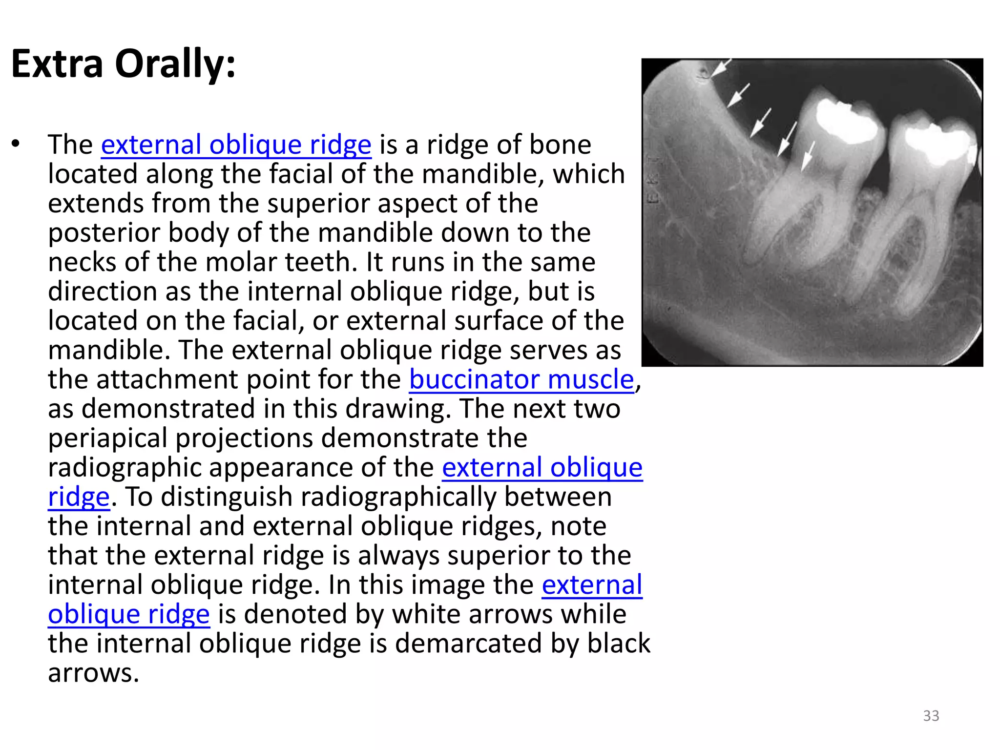 Obliuqe Ridge Anatomical landmarks in Periapical and Orthopantomogram X-ray | PPTX