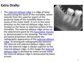 Oblique Ridge Radiography Anatomical landmarks in Periapical and Orthopantomogram X-ray | PPTX