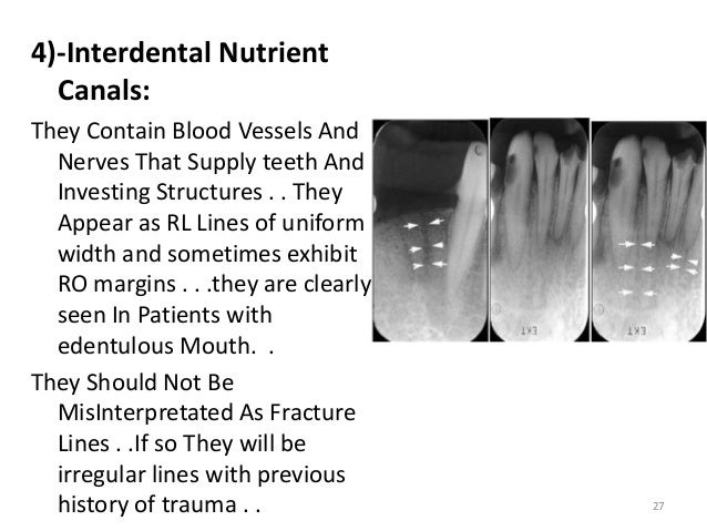 mandible parts of Anatomical in Periapical and ray X Orthopantomogram landmarks
