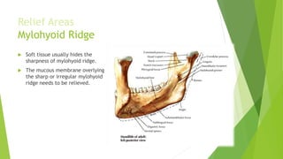 Anatomical landmarks for edentulous patients and facial landmarks | PPTX