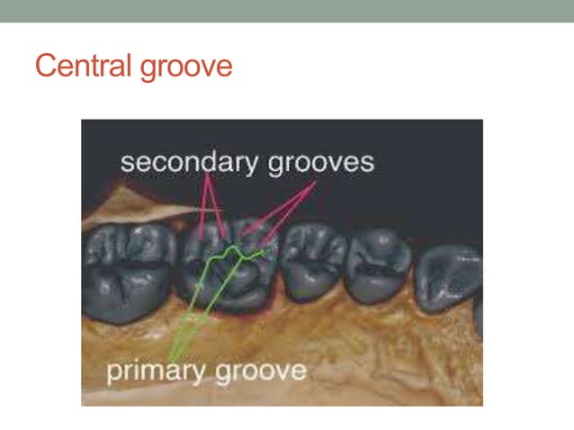 Anatomical land marks of a tooth | PPTX | Dental Health | Diseases and ...