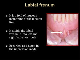 Right Labial anatomicallandmarksofdenturebearingareaof-130812025925-phpapp02.pptx