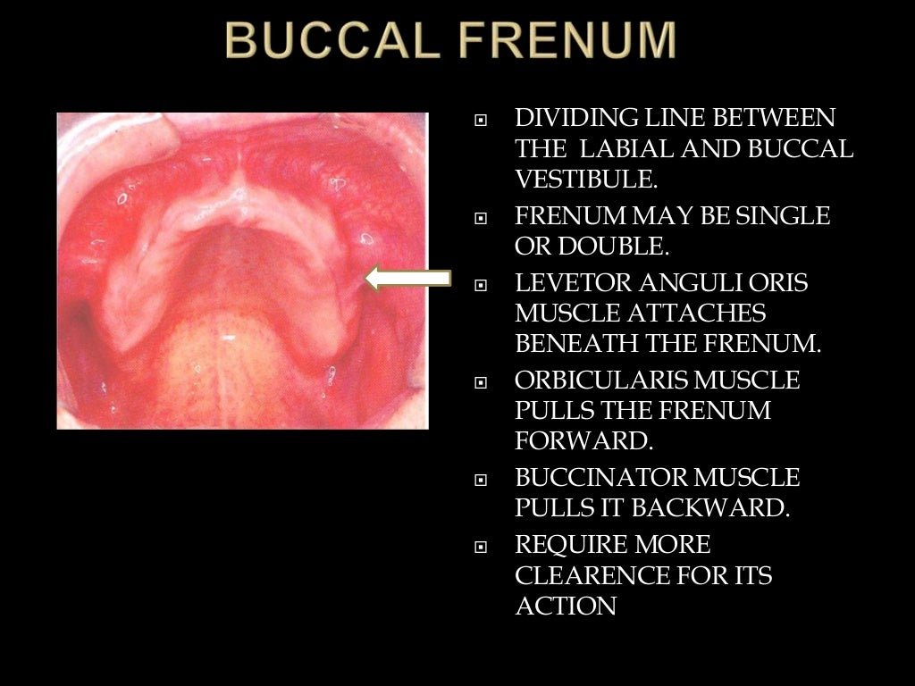 Anatomical landmarks of denture bearing area of.pptx final