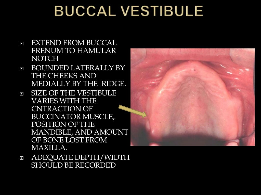 Anatomical landmarks of denture bearing area of.pptx final