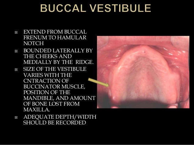 anatomical landmarks of denture bearing area of pptx final hamular notch