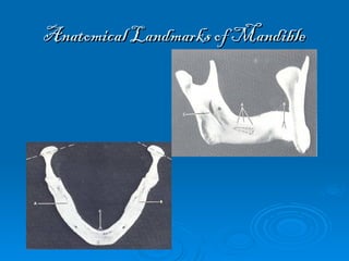 Anatomical Landmarks of Mandibular arches.ppt