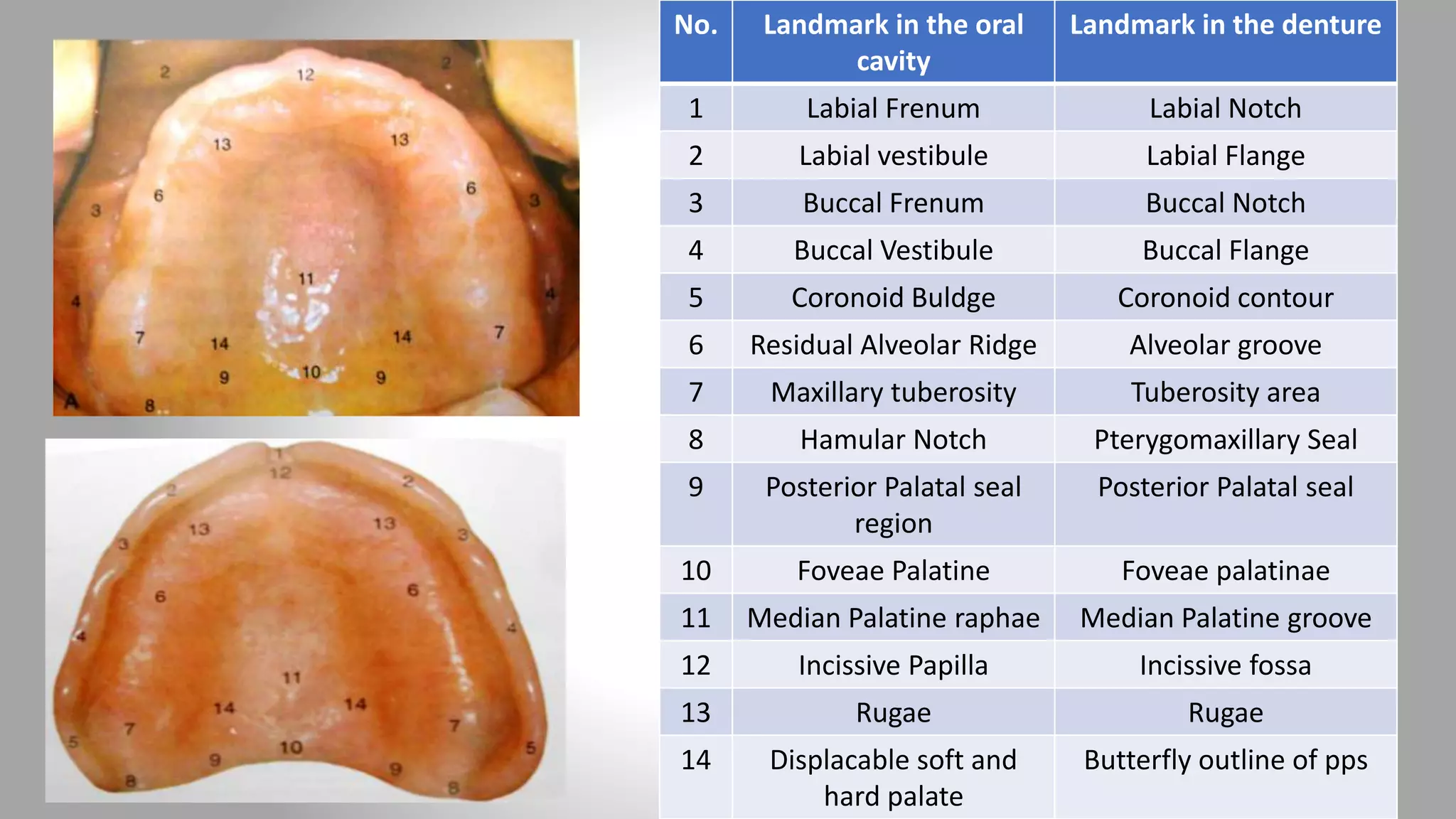 Left Labial Area Anatomical landmarks of maxilla | PPTX