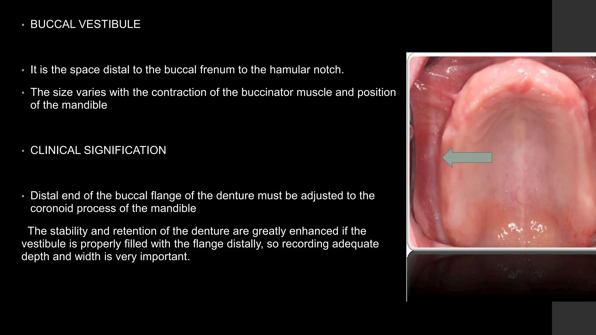 ANATOMICAL LANDMARKS OF MAXILLA AND MANDIBLE.pptx