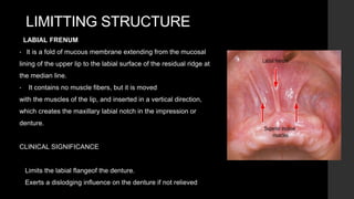 ANATOMICAL LANDMARKS OF MAXILLA AND MANDIBLE.pptx
