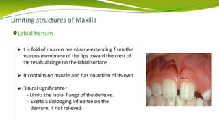 Limiting structures of Maxilla
⚫Labial frenum
It is fold of mucous membrane extending from the
mucous membrane of the lips toward the crest of
the residual ridge on the labial surface.
 It contains no muscle and has no action of its own.
Clinical significance :
- Limits the labial flange of the denture.
- Exerts a dislodging influence on the
denture, if not relieved.
 
