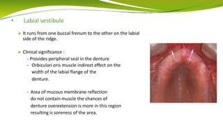 • Labial vestibule
 It runs from one buccal frenum to the other on the labial
side of the ridge.
 Clinical significance :
- Provides peripheral seal in the denture
- Orbiculari oris muscle indirect effect on the
width of the labial flange of the
denture.
- Area of mucous membrane reflection
do not contain muscle the chances of
denture overextension is more in this region
resulting is soreness of the area.
 