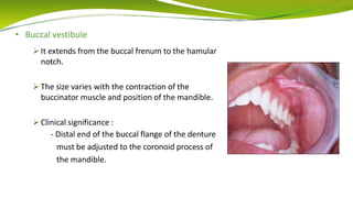 • Buccal vestibule
 It extends from the buccal frenum to the hamular
notch.
 The size varies with the contraction of the
buccinator muscle and position of the mandible.
 Clinical significance :
- Distal end of the buccal flange of the denture
must be adjusted to the coronoid process of
the mandible.
 