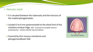 • Hamular notch
 It is situated between the tuberosity and the hamulus of
the medial pterygoid plate.
 Located 2 to 4 mm posteromedial to the distal limit of the
maxillary residual ridge. (Ref : Essentials of complete denture
prosthodontics : Sheldon Winkler (Second Edition)
 Covered by thin mucous membrane and
pterygomandibular fold.
 
