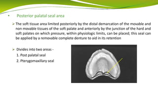 • Posterior palatal seal area
 The soft tissue area limited posteriorly by the distal demarcation of the movable and
non movable tissues of the soft palate and anteriorly by the junction of the hard and
soft palates on which pressure, within physiologic limits, can be placed; this seal can
be applied by a removable complete denture to aid in its retention
 Divides into two areas -
1. Post palatal seal
2. Pterygomaxillary seal
 