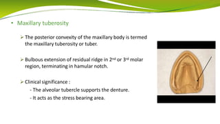 • Maxillary tuberosity
 The posterior convexity of the maxillary body is termed
the maxillary tuberosity or tuber.
 Bulbous extension of residual ridge in 2nd or 3rd molar
region, terminating in hamular notch.
 Clinical significance :
- The alveolar tubercle supports the denture.
- It acts as the stress bearing area.
 