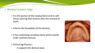 • Residual alveolar ridge
 It is the portion of the residual bone and its soft
tissue covering that remains after the removal of
teeth.
 It forms the foundation of the denture.
 It has underlying cancellous bone which resorbs
under constant stresses.
 Clinical significance :
- It supports the denture base.
 
