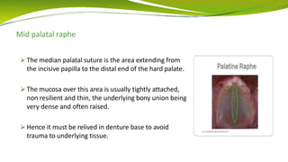 Mid palatal raphe
 The median palatal suture is the area extending from
the incisive papilla to the distal end of the hard palate.
 The mucosa over this area is usually tightly attached,
non resilient and thin, the underlying bony union being
very dense and often raised.
 Hence it must be relived in denture base to avoid
trauma to underlying tissue.
 