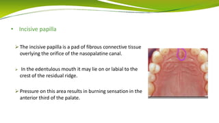 • Incisive papilla
 The incisive papilla is a pad of fibrous connective tissue
overlying the orifice of the nasopalatine canal.
 In the edentulous mouth it may lie on or labial to the
crest of the residual ridge.
 Pressure on this area results in burning sensation in the
anterior third of the palate.
 