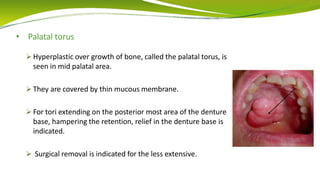 • Palatal torus
 Hyperplastic over growth of bone, called the palatal torus, is
seen in mid palatal area.
 They are covered by thin mucous membrane.
 For tori extending on the posterior most area of the denture
base, hampering the retention, relief in the denture base is
indicated.
 Surgical removal is indicated for the less extensive.
 